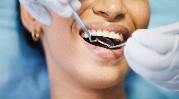Best Emergency Broken Tooth Repair in Manchester, OH